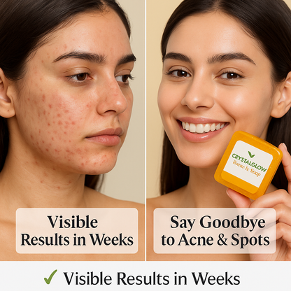 Zk Beauty TURMERIC SOAP 115gm